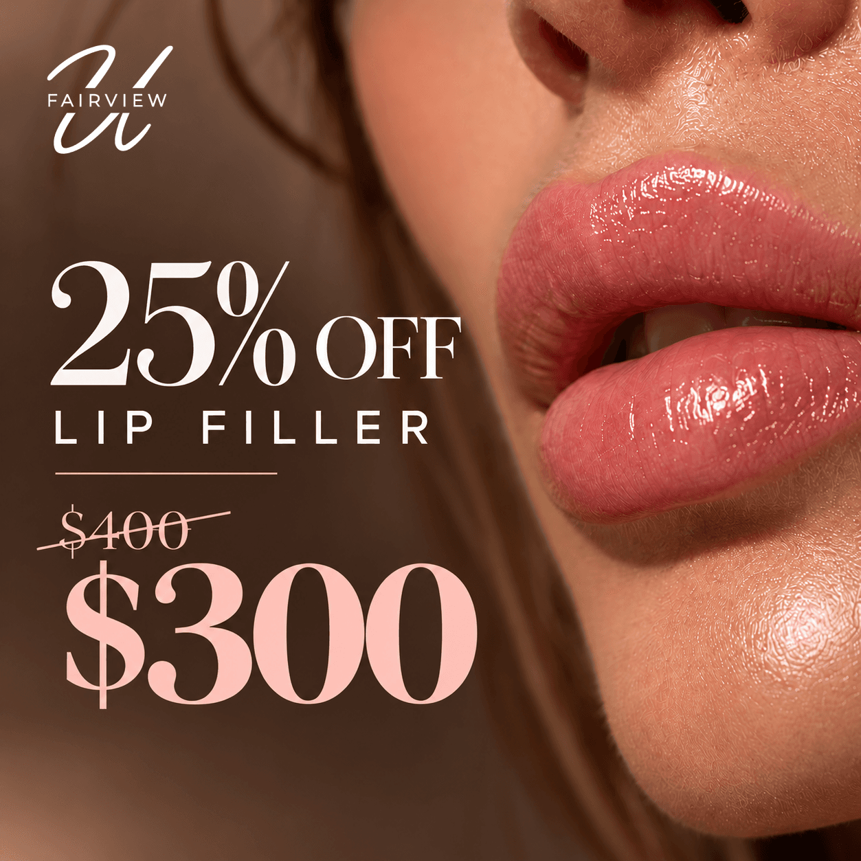 Lip filler offer